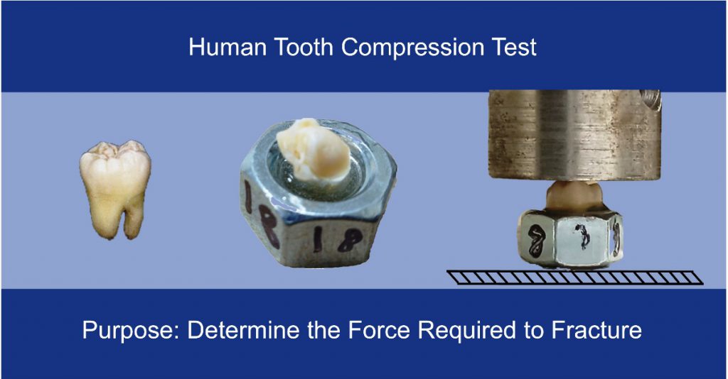 ASU Senior Thesis Human Tooth Compression Test Westpak